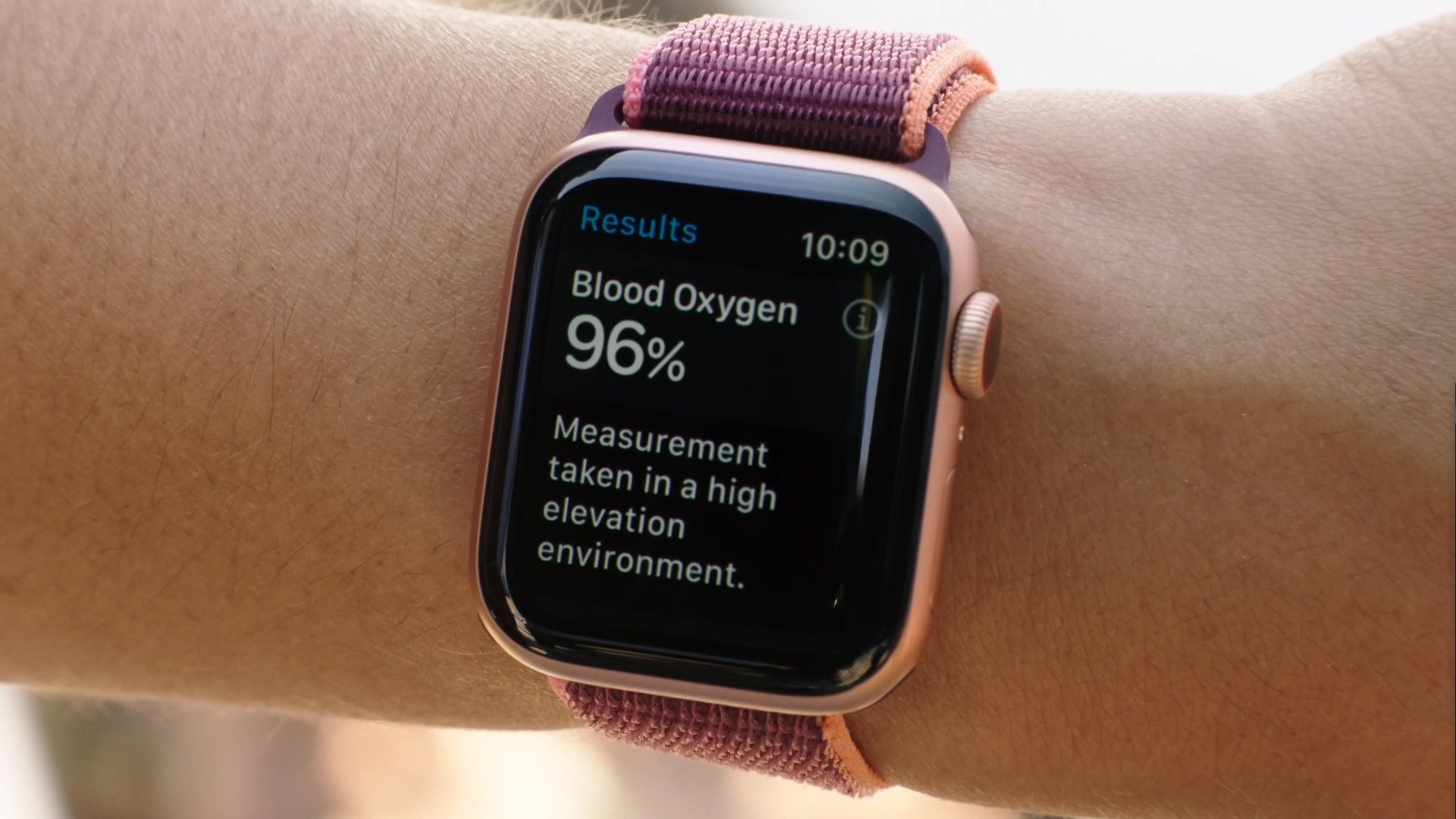 苹果watch中国版applewatch客服电话